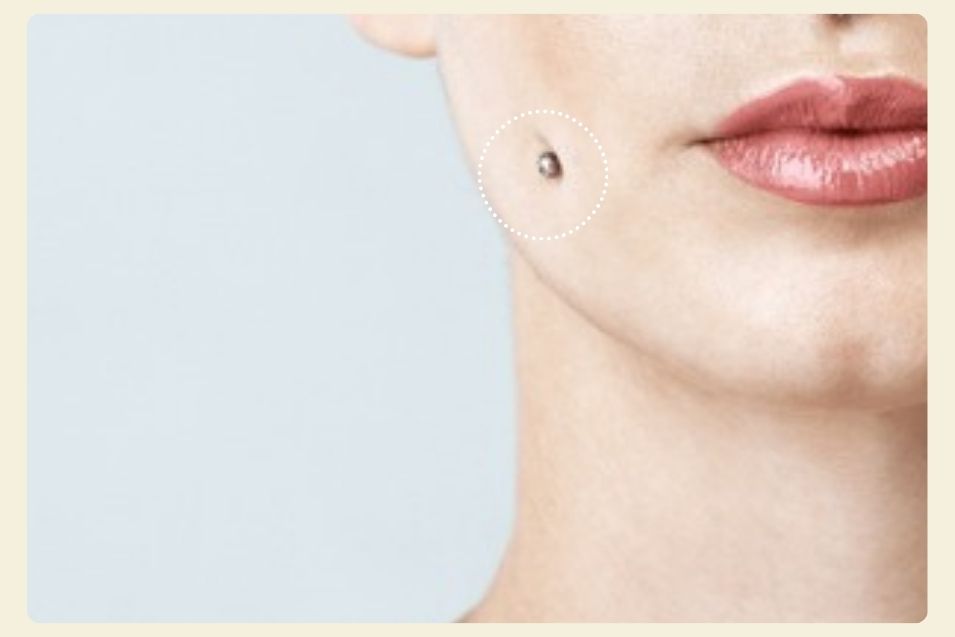 Dermal Piercing