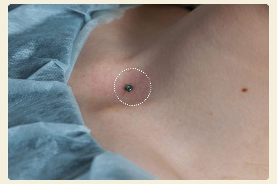 Dermal Piercing Aftercare