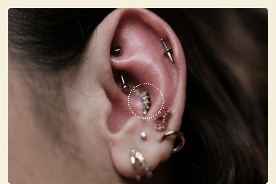 conch piercing