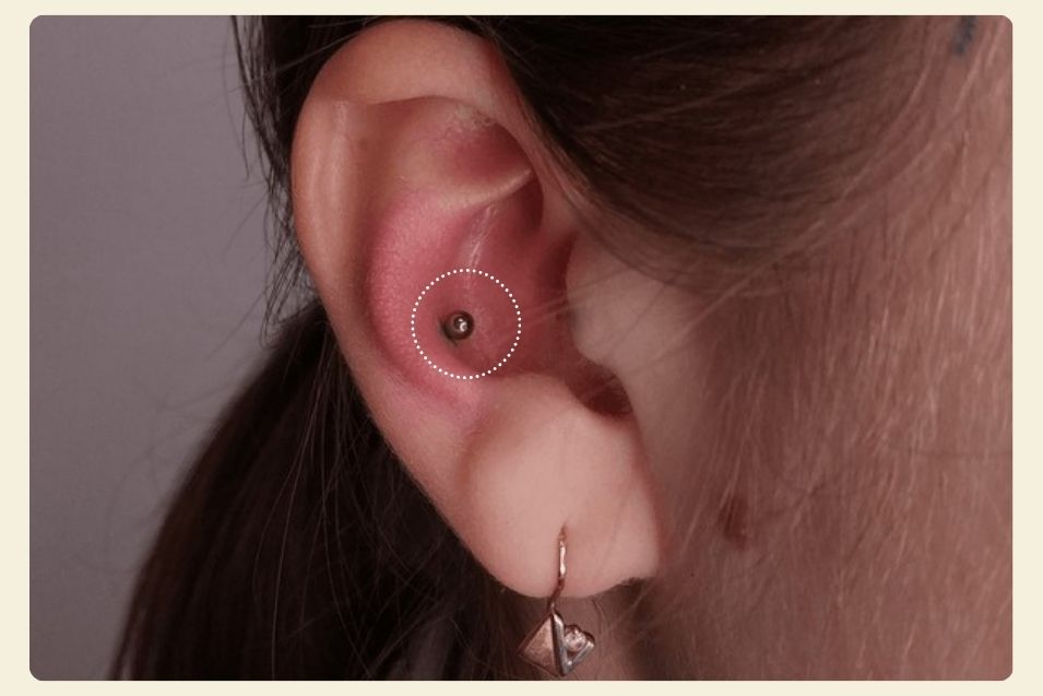 conch piercing